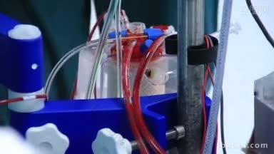 心脏手术中人工心肺机电路的基本要素医疗队在进行手术时人工血液循环装置的工作